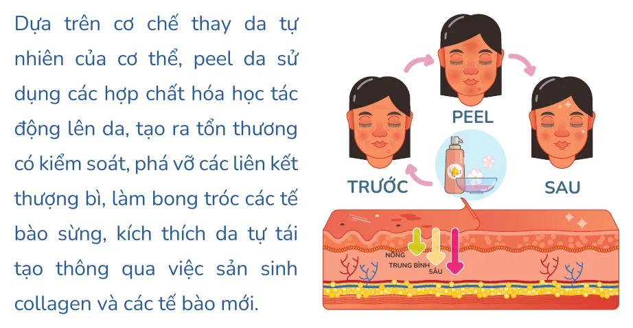 Minh hoạ trong chương “Các liệu pháp điều trị khác Dược mỹ phẩm peel da laser” — sách Hiểu mụn để hết mụn