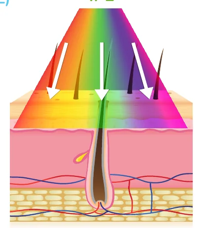 Minh hoạ trong chương “Các liệu pháp điều trị khác Dược mỹ phẩm peel da laser” — sách Hiểu mụn để hết mụn