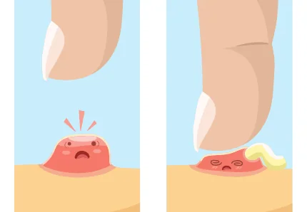 Minh hoạ trong chương “Các vấn đề khác” — sách Hiểu mụn để hết mụn