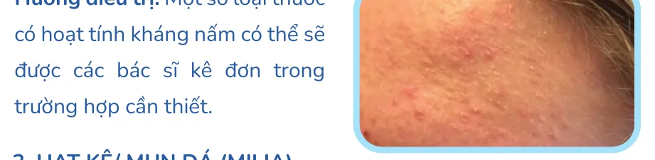 Minh hoạ trong chương “Chín tình trạng giống mụn, nhưng không phải mụn” — sách Hiểu mụn để hết mụn