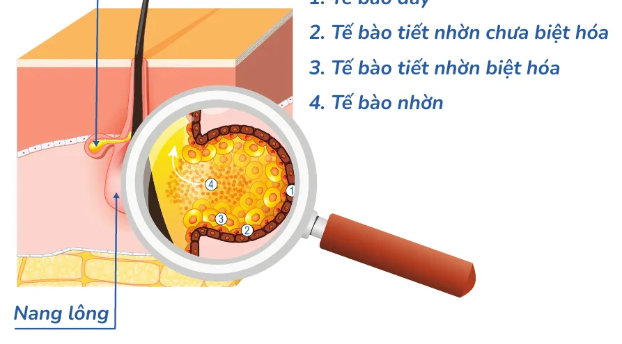 Minh hoạ trong chương “Lợi thế của làn da nhờn” — sách Hiểu mụn để hết mụn