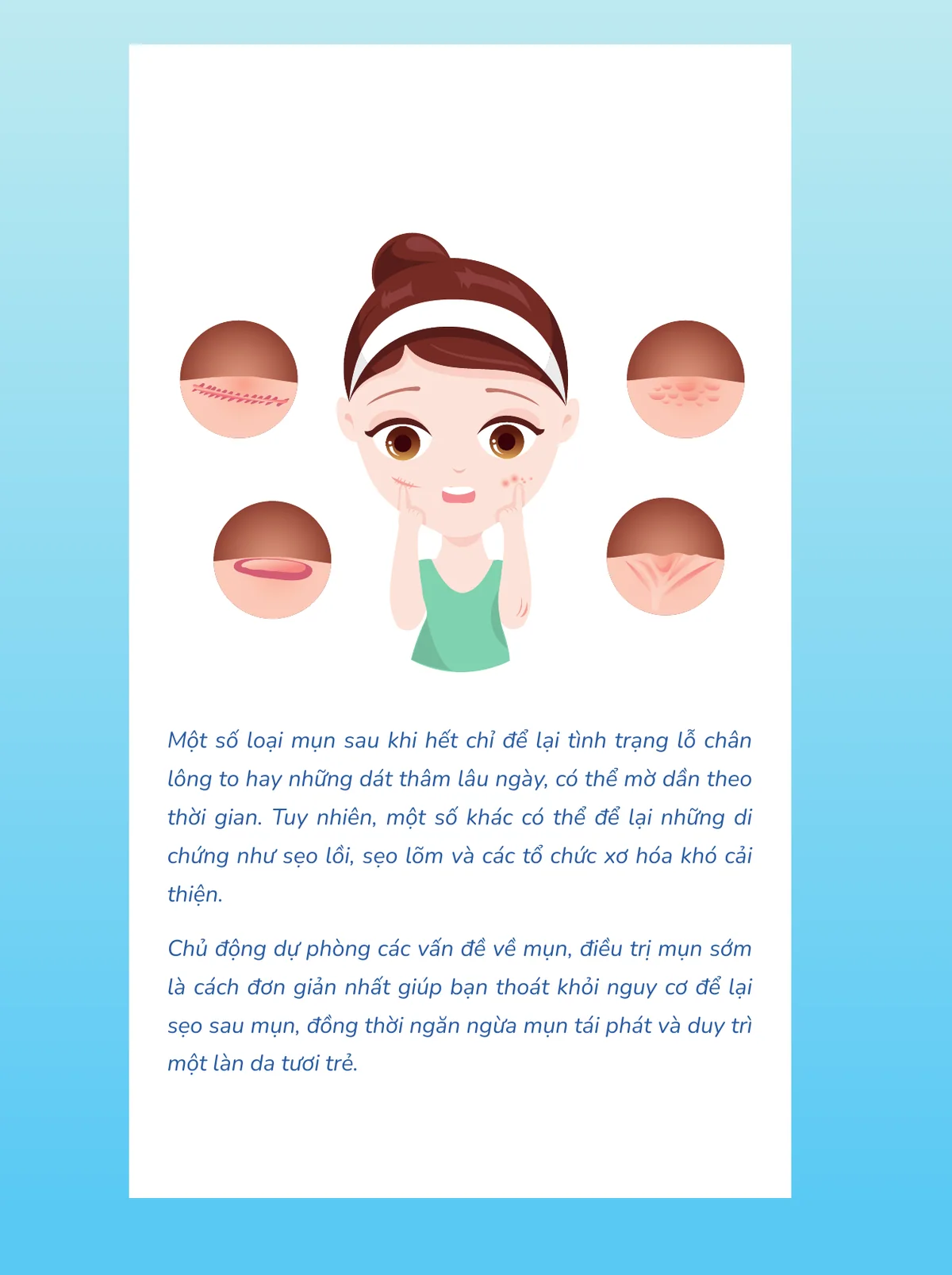 Minh hoạ trong chương “Tổng hợp những sai lầm thường gặp trong chăm sóc da mụn” — sách Hiểu mụn để hết mụn