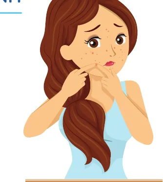 Minh hoạ trong chương “Mụn ở từng giai đoạn khác nhau như thế nào” — sách Hiểu mụn để hết mụn