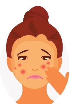 Minh hoạ trong chương “Nguyên nhân gây mụn” — sách Hiểu mụn để hết mụn