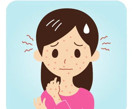 Minh hoạ trong chương “Trị mụn trên cơ thể có gì khác so với trị mụn trên mặt” — sách Hiểu mụn để hết mụn