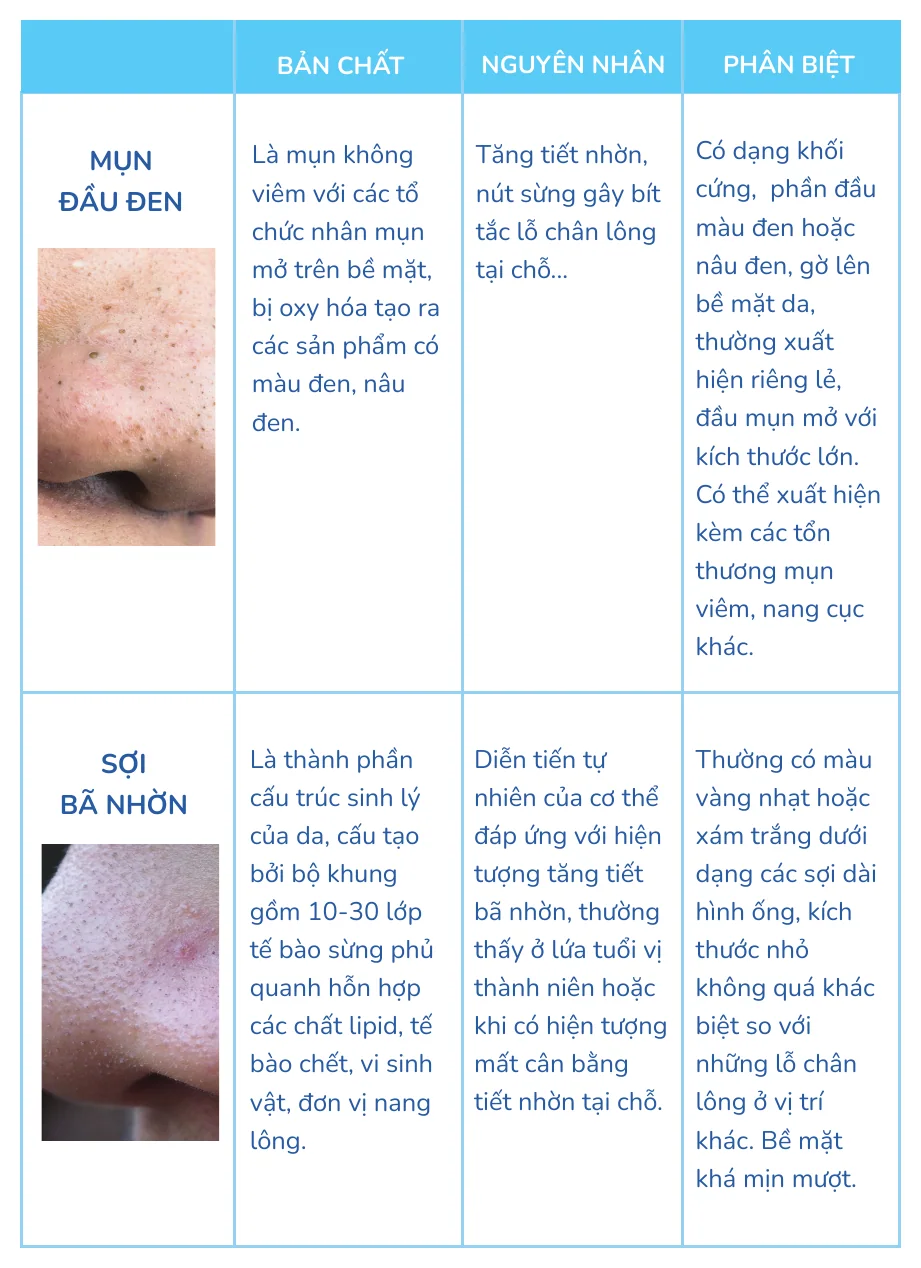 Minh hoạ trong chương “Phân biệt mụn đầu đen, sợi bã nhờn và trichostasis spinulosa” — sách Hiểu mụn để hết mụn
