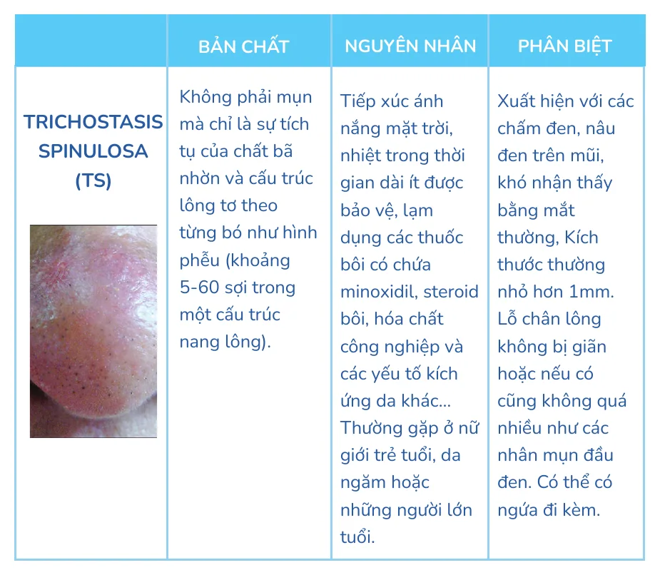 Minh hoạ trong chương “Phân biệt mụn đầu đen, sợi bã nhờn và trichostasis spinulosa” — sách Hiểu mụn để hết mụn
