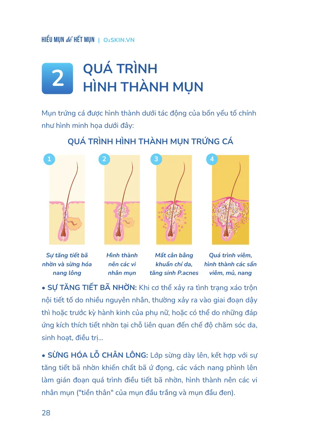 Trang 028 bản in của sách Hiểu mụn để hết mụn