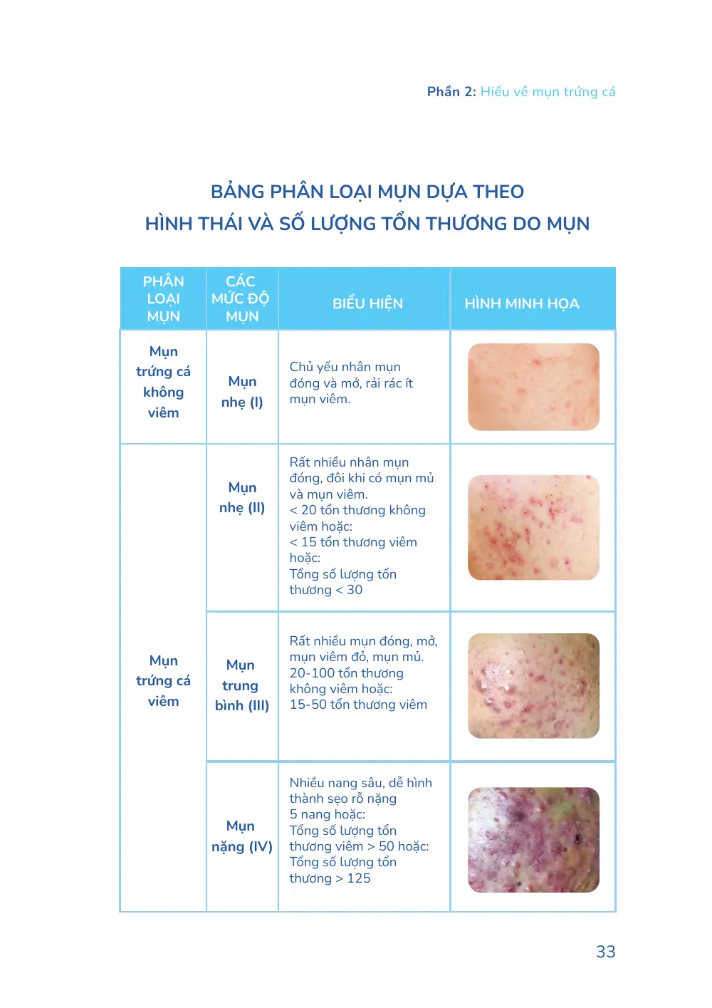 Trang 033 bản in của sách Hiểu mụn để hết mụn