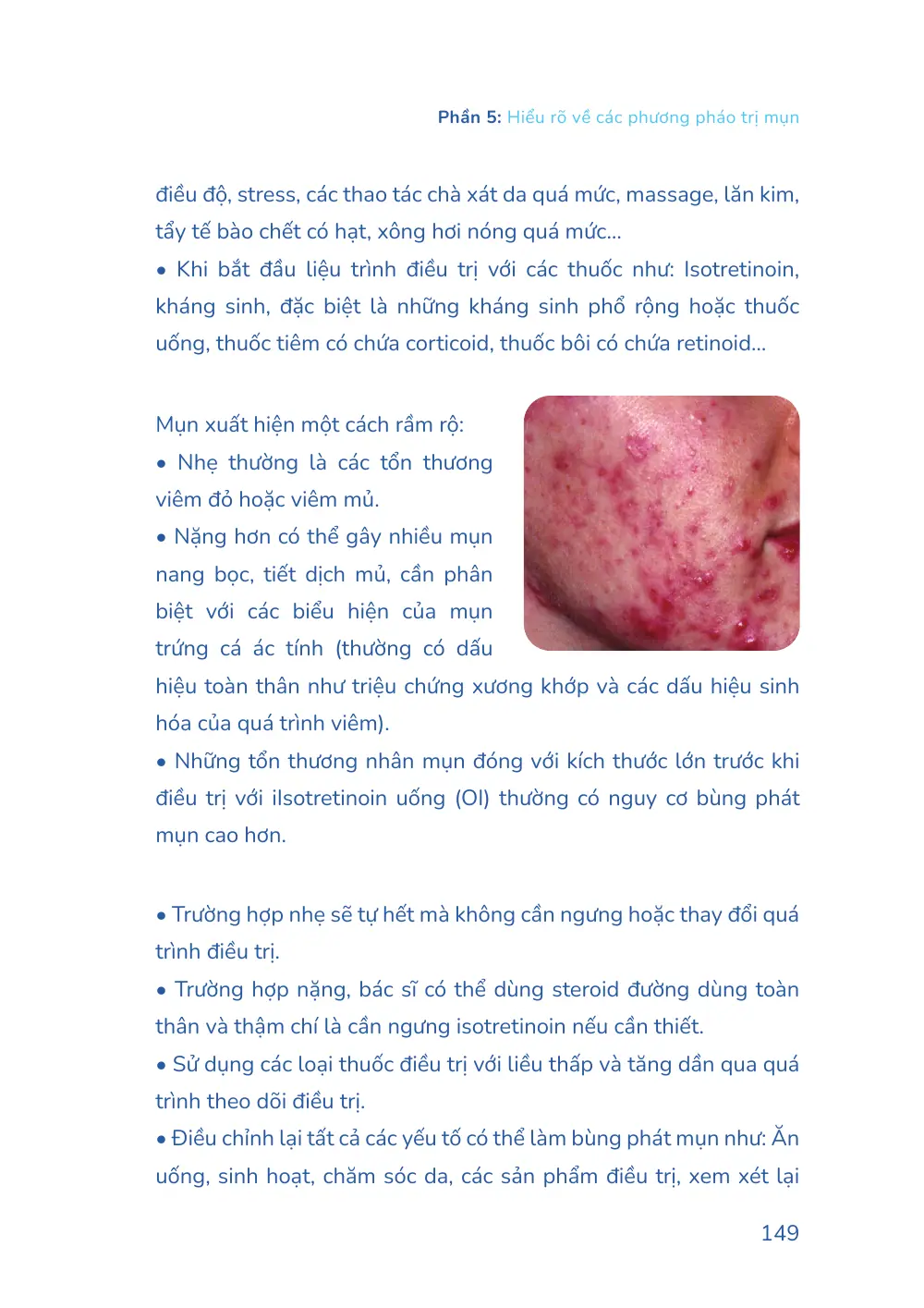 Trang 149 bản in của sách Hiểu mụn để hết mụn
