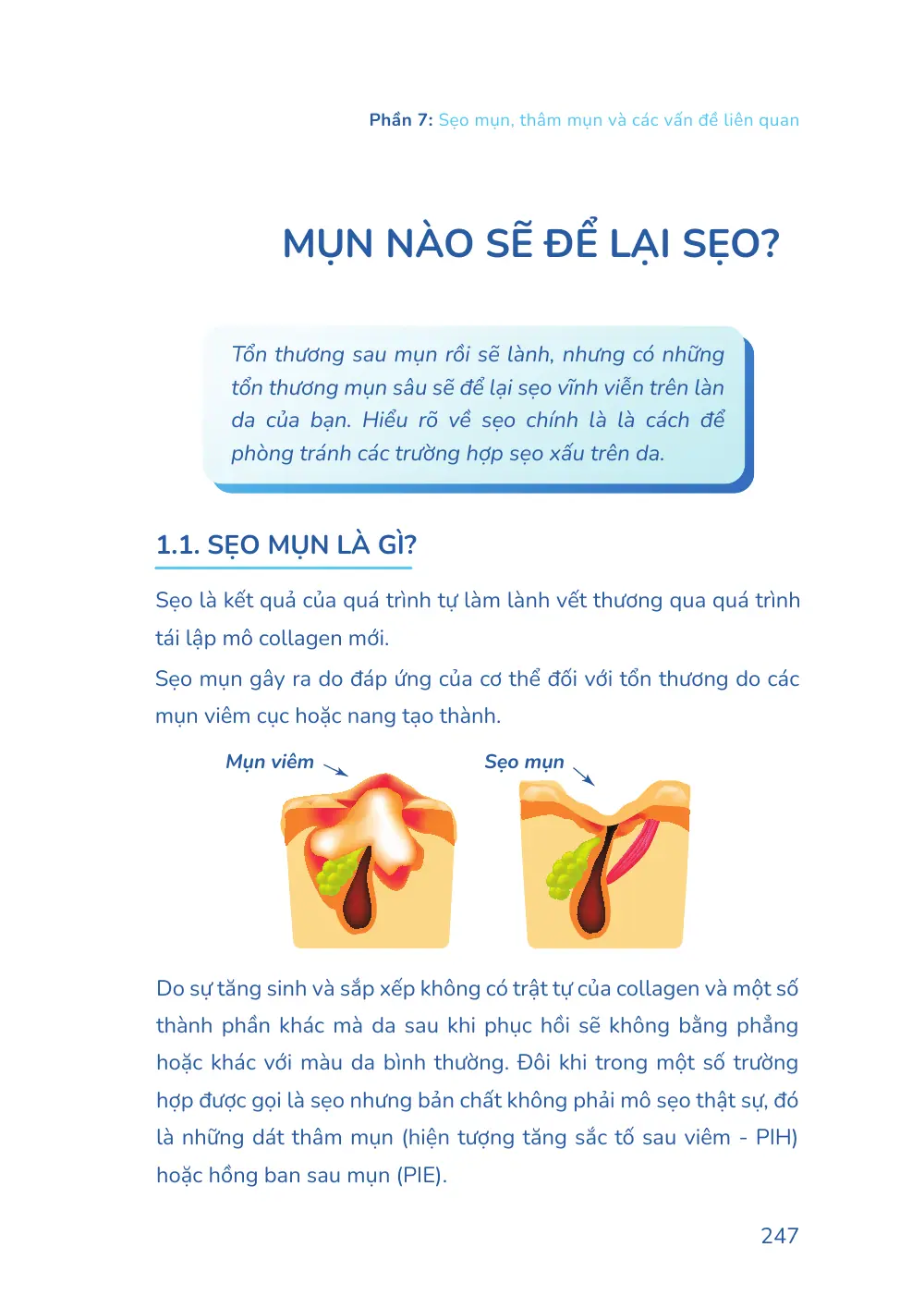 Trang 247 bản in của sách Hiểu mụn để hết mụn