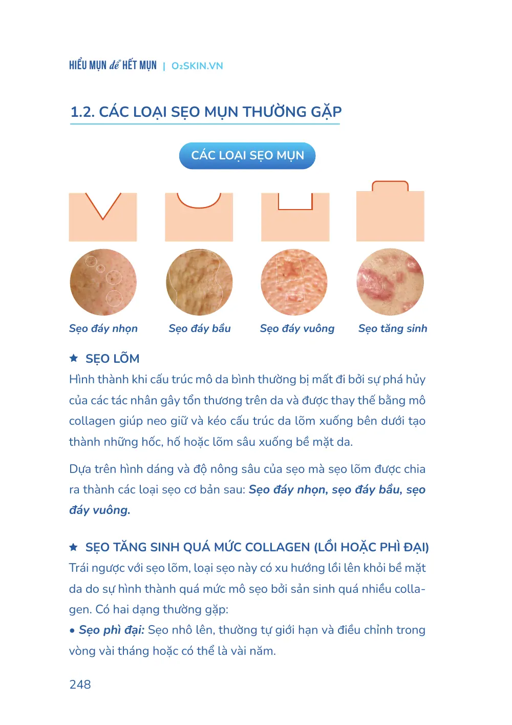 Trang 248 bản in của sách Hiểu mụn để hết mụn