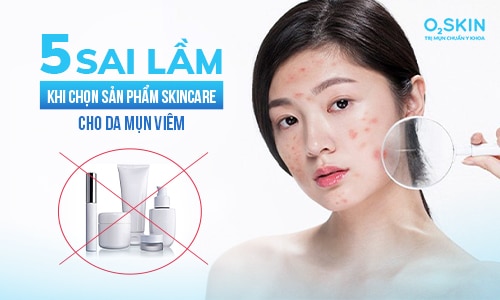 5 sai lầm khi chọn sản phẩm chăm sóc da mụn viêm