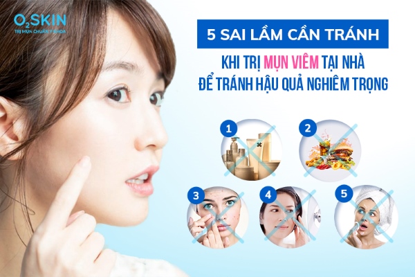 5 Sai Lầm Nghiêm Trọng Cần Tránh Khi Tự Trị Mụn Viêm Tại Nhà