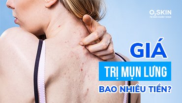 Tìm Hiểu Giá Trị Mụn Lưng Bao Nhiêu Tiền Tại O₂ SKIN?