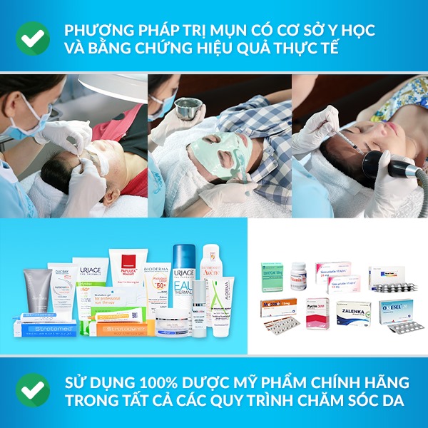 Liệu trình “ Trị Mụn Chuẩn Y Khoa” của O2 SKIN.