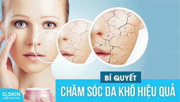 Bí Quyết Chăm Sóc Da Khô Hiệu Quả