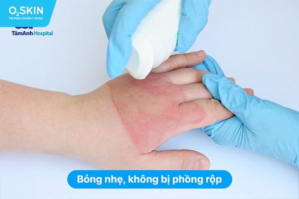 Bỏng nhẹ, không bị phồng rộp.