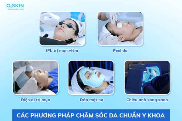 các bước trang điểm cơ bản cho da dầu mụn