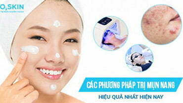 Cách trị mụn nang tại nhà với các nguyên liệu thiên nhiên 