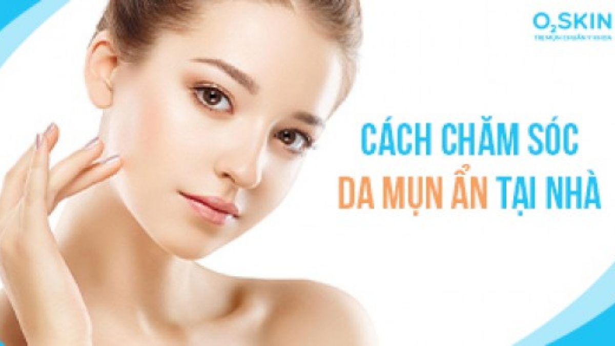 Cách Chăm Sóc Da Mụn Ẩn: Bí Quyết Giúp Da Khỏe Đẹp