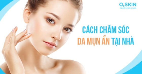 Các bước skincare cho da mụn ẩn tại nhà nhất định phải biết