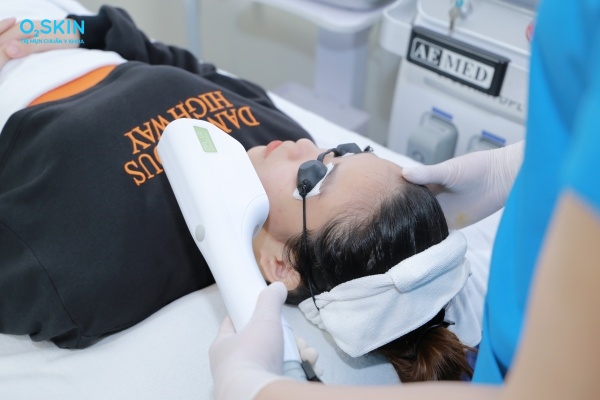 Cách điều trị mụn nang