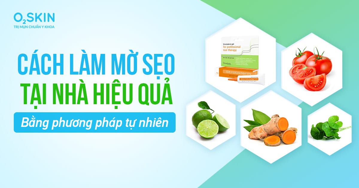 Cách làm mờ sẹo tại nhà hiệu quả bằng phương pháp tự nhiên