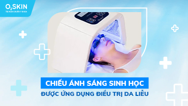 Công Nghệ Chiếu Ánh Sáng Xanh Điều Trị Mụn Viêm Tại O2 SKIN