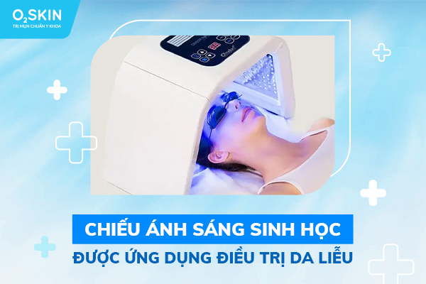 Công Nghệ Chiếu Ánh Sáng Xanh Điều Trị Mụn Viêm Tại O2 SKIN