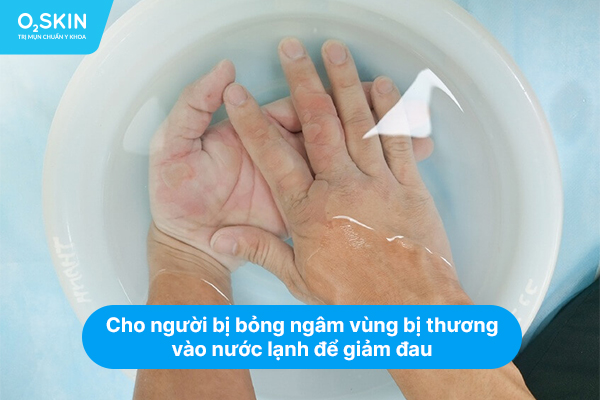 Cho người bị bỏng ngâm vùng bị thương vào nước lạnh để giảm đau.