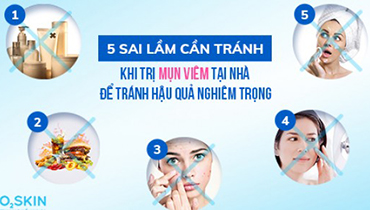 5 Sai Lầm Nghiêm Trọng Cần Tránh Khi Tự Trị Mụn Viêm Tại Nhà Mùa Giãn Cách