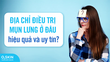 Địa Chỉ Điều Trị Mụn Lưng Ở Đâu Hiệu Quả Và Uy Tín?