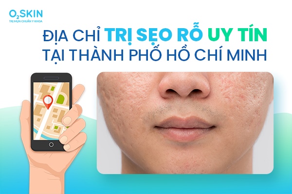 Địa chỉ trị sẹo rỗ uy tín tại Thành phố Hồ Chí Minh