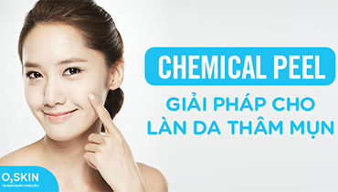 Peel da bao nhiêu tiền? Giá Peel da trị mụn tại O2 SKIN?