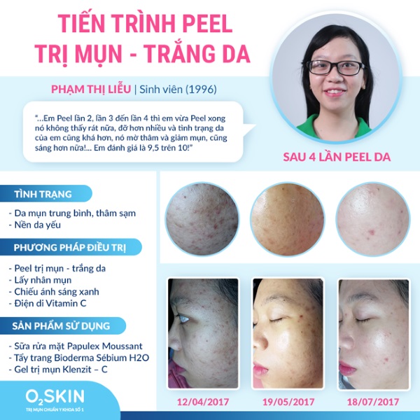 Hiệu quả của Peel da