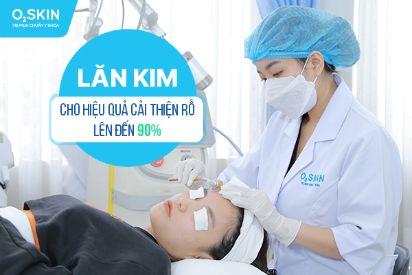 Lăn kim cho hiệu quả cải thiện rỗ lên đến 90% (*)