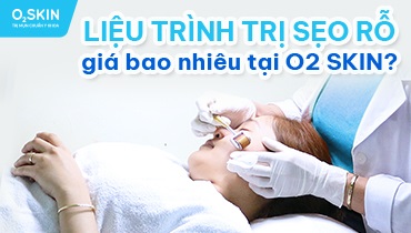 Liệu trình trị sẹo rỗ giá bao nhiêu?