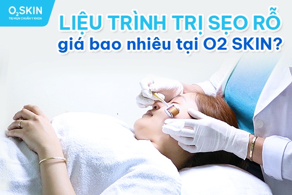 Liệu trình trị sẹo rỗ giá bao nhiêu tại O2 SKIN?