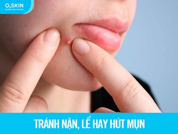 Tránh nặn, lể hay hút mụn.