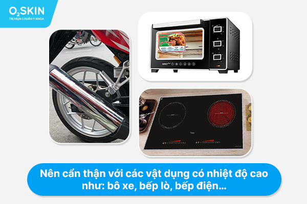 Nên cẩn thận với các vật dụng có nhiệt độ cao như: bô xe, bếp lò, bếp điện…