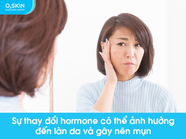 nguyên nhân gây mụn trứng cá