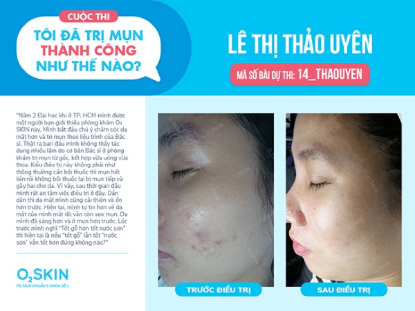 Bạn Lê Thị Thảo Uyên