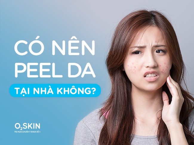 Có nên peel da tại nhà hay không?