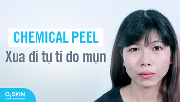 Chemical Peel - Xua Đi Tự Ti Do Mụn - Trần Thị Hương