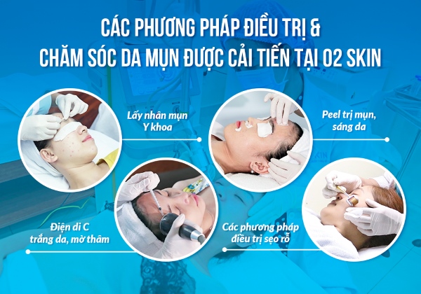 Dịch vụ điều trị mụn tại O2 SKIN.