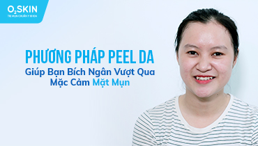 Bạn Bích Ngân Vượt Qua Mặc Cảm Mặt Mụn Với Phương Pháp Peel Da