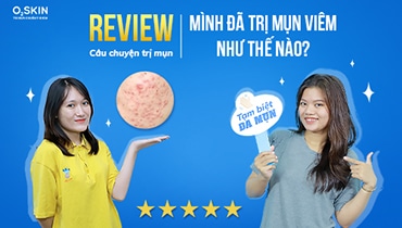 Gen Z review: Mình đã trị mụn viêm như thế nào?