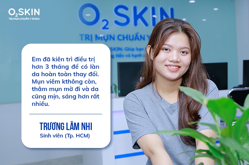 Tình trạng da trước khi điều trị mụn của Lâm Nhi.