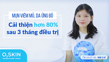 2K Cần Thơ Chia Sẻ Hành Trình Phục Hồi Da Mụn Nặng Nhờ Phương Pháp Chuẩn Y Khoa